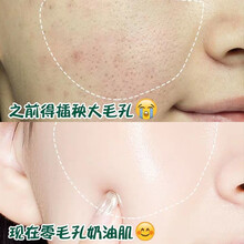 【修复大毛孔】收缩毛孔精华液去黑头乳糖酸原液修复毛孔粗大细致毛孔 萃然美 一周期3瓶装【深层修复】