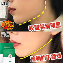 医后v脸面膜瘦小脸面膜女提拉紧致补水保V脸绷带瘦小脸面罩胶原瘦咬肌仪婴儿肥紧致双下巴挂耳贴面膜 5盒25片【周期改造 店长推荐】