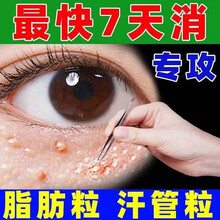 新款草本祛眼部油脂粒汗管瘤眼霜膏脂肪粒淡化黑眼圈袋眼部细纹 1瓶