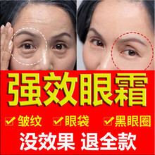 蛇毒眼膜眼袋贴眼贴膜烟酰胺去黑眼圈眼袋细皱纹眼袋消紧致抗皱眼纹消淡化皱纹保湿补水舒缓男女可用慕漾 三瓶装(巩固提升解决所有眼部问题)