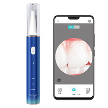 小米可视超声波洁牙仪家用口腔清洁冲牙洗牙神器溶解牙结石去除器 智能可视超声波洁牙仪-蓝色【小米有品】