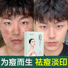 【黄圣依同款】祛痘面膜女男护肤品 积雪草玻尿酸补水保湿收缩毛孔 去痘去黑头粉刺闭口控油淡化痘印梵贞 五盒装=159【每盒低至31.8，95%客户选择】