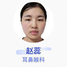 赵蕊 耳鼻喉科 住院医师 陕西省第四人民医院