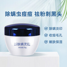 广德堂新肤螨灵霜20g去痘脸部除螨霜控油收缩毛孔小蓝瓶除螨祛痘膏