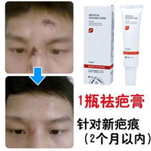 祛疤膏修复无痕去疤膏凹凸疤增生脸上老疤伤巴芦荟胶复平焕颜神器 一盒