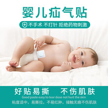 ??宝妈医用婴儿脐疝贴新生儿疝气带儿童男女凸肚脐突出贴透气 20天(40片脐疝贴+2小疝包+2吸水包) 均码