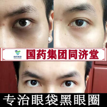 【国药集团同济堂】类蛇毒眼霜黑眼圈眼袋消除男士细纹脂肪粒淡化抗皱纹提拉紧致女士通用 一瓶装大容量50g