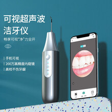 初先智能可视超声波洁牙仪便携式洗牙器牙结石去除器冲牙器水牙线电动牙齿清洁器家用儿童清理口腔手持神器 雅白：高清可视+超声波清洁+全身防水