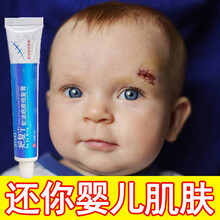 疤痕一抹消去疤痕倍舒痕祛疤膏去疤痕修复无痕美过疤克祛疤腿部 紧致肌肤【告别新疤】