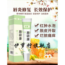 唇研康口唇炎唇膏唇研康用软膏嘴唇干裂脱皮起皮起泡嘴复角开裂润唇油LX 【1支装】唇妍康