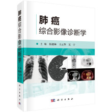 肺癌综合影像诊断学