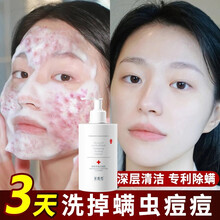 氨基酸洗面奶控油祛痘泡沫卸妆去黑头收缩毛孔粗大抗痘印除螨虫去角质美肤白皙水杨酸深层清洁面乳男女美嘉秀 一瓶装大容量400ml【买二贈一】