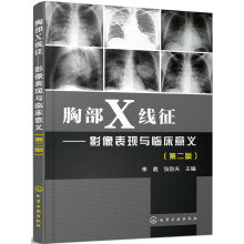 胸部X线征 影像表现与临床意义（第二版）
