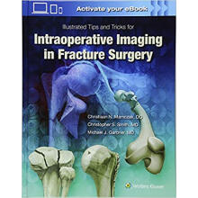 Illustrated Tips and Tricks for Intraoperative I