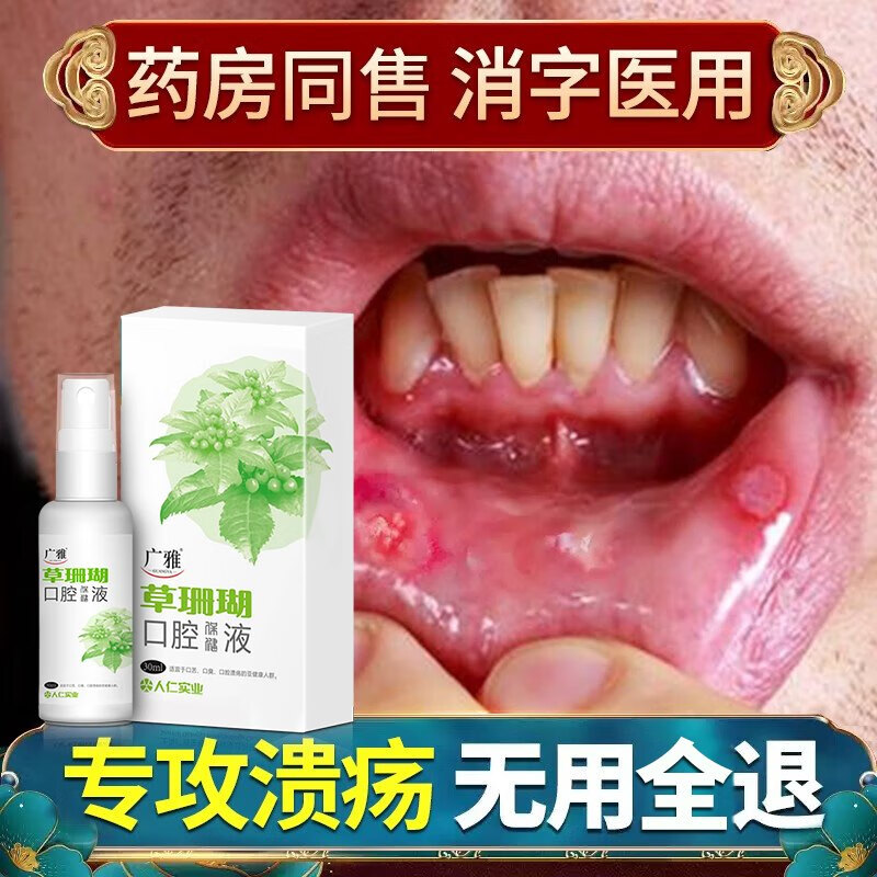 【好物推荐】口腔溃疡喷剂喷雾 30ml