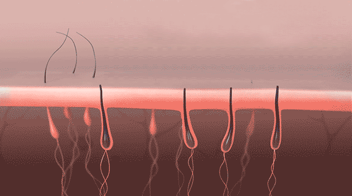 激光冰感脱毛仪家用剃毛脱毛器全身唇毛腋毛电动脱毛机女士 二代(冰感