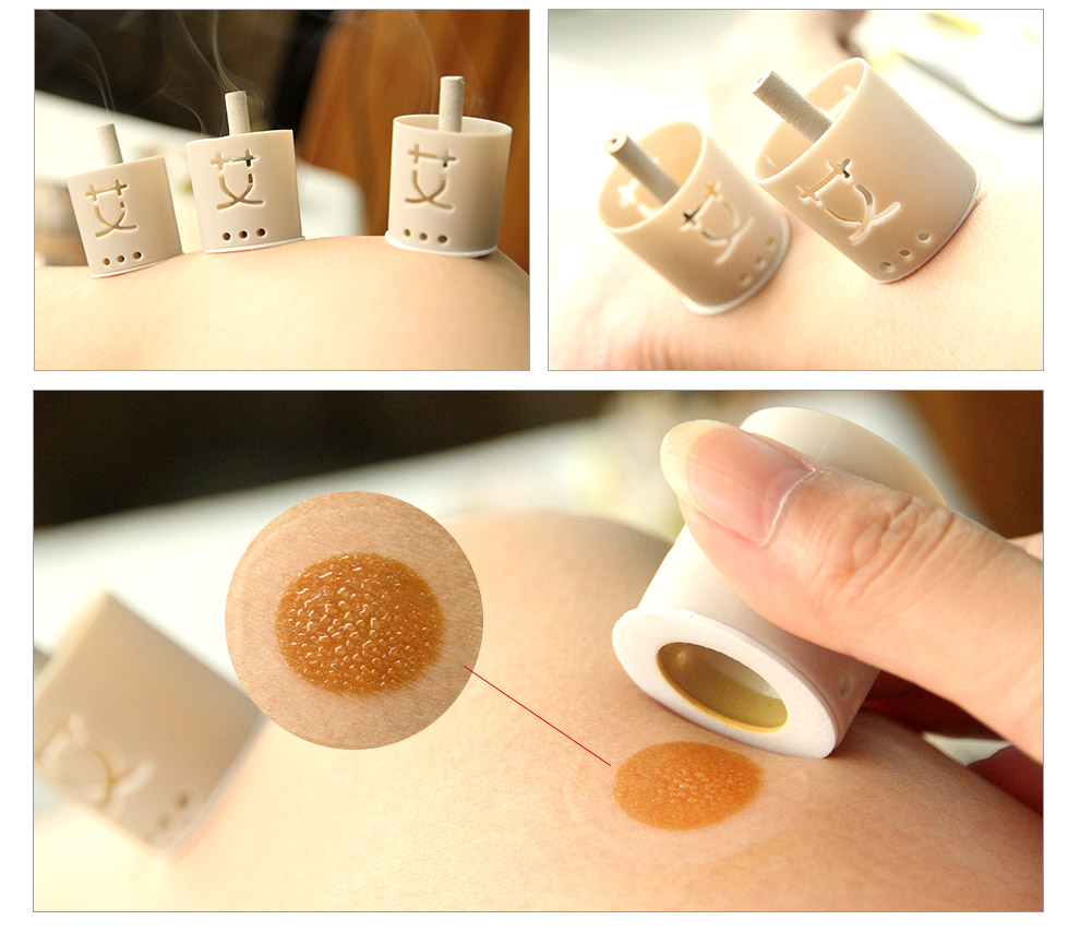 佳亿本草(jayea) 防护款艾灸贴60粒蕲艾艾灸贴随身灸艾条艾贴艾灸三伏